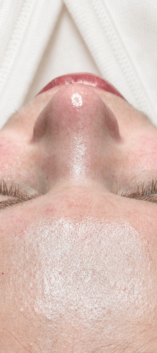 dermadrop after