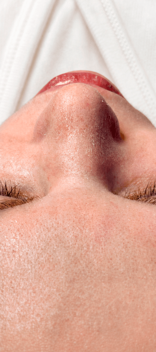 dermadrop before